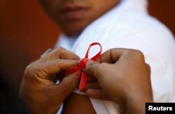 Ушбу кўринишдаги қизил тасма ОИВ/ОИТСга қарши кураш рамзи ҳисобланади.