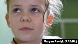 Ці цяточки на обличчі залишились після поранення