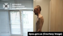 У такому фізичному стані з російського полону повернувся український прикордонник під час обміну полоненими 31 травня 2024 року