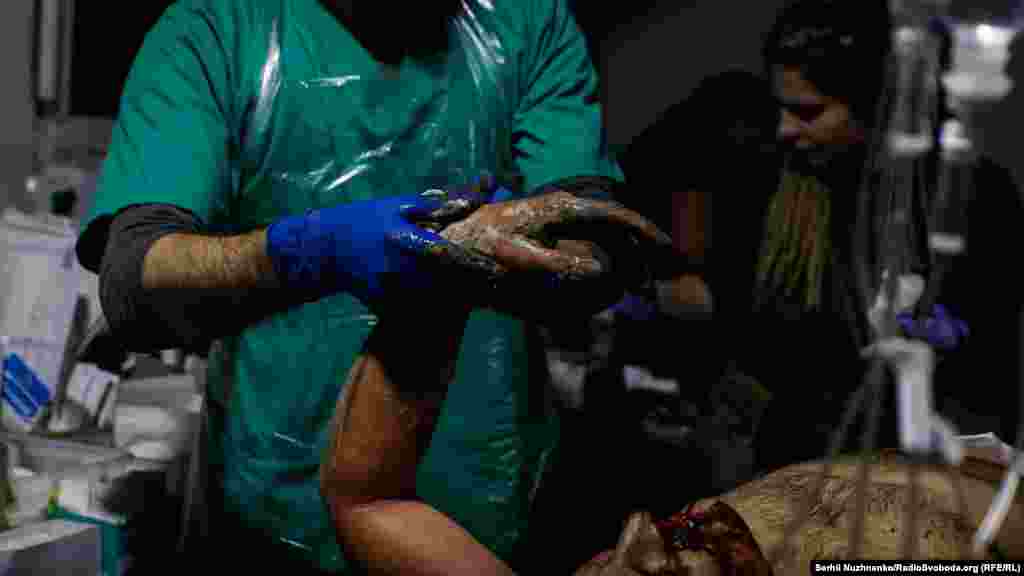 Бійці часто потрапляють до медиків, укриті товстим шаром бруду. Війна&nbsp;&ndash; це бруд і кров. &nbsp; Тож, у процесі надання медичної допомоги, лікарі ще й змивають із поранених грязюку та бруд боїв.