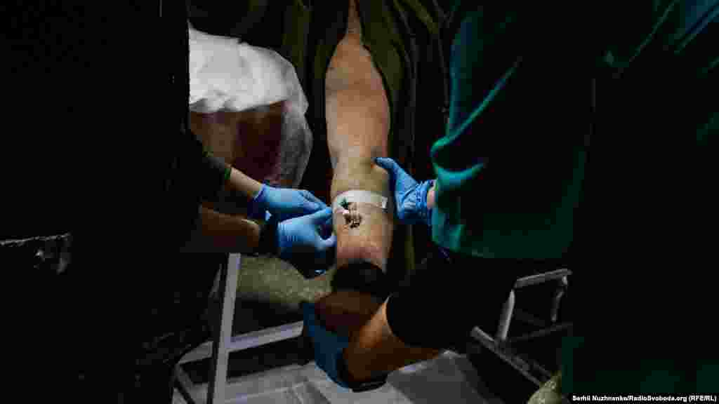 Пораненому вставляють в руку катетер, як кажуть медики: &laquo;поставити вену&raquo;. Це допомагає вести в організм людини необхідні медпрепарати, що полегшать біль та стабілізують стан пацієнта.