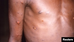 мајмунски сипаници