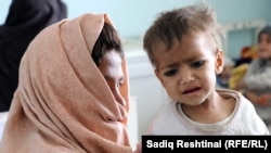 یکی از اطفال مبتلا به سوء تغذی که به شفاخانه شهر قندهار بستر شده است.
