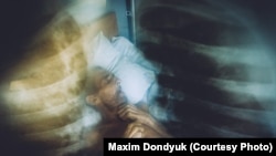 ارشیف: په نري رنځ اخته یو کس تر درملنې لاندې دی