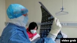 Radiografie Covid 19