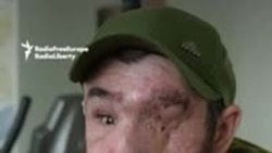 Ukrainian Mine Blast Survivor Navigates The World Without Sight