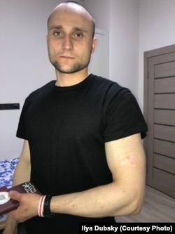 Former political prisoner Ilya Dubsky. The wound on his left arm is clearly visible. (click to enlarge)