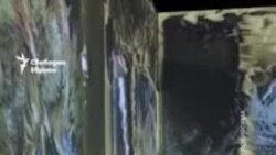 "От Фрида Кало до Стиви Уондър". Изложба разказва историите на хора с увреждания, променили света