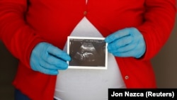 O ecografie într-un spital sau policlinică privată costă în jur de 500 RON. Statul și-a asumat plata ecografiilor pentru gravide. 