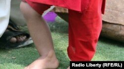 ارشیف، په پولیو د یوې اخته افغانې ماشومې انځور