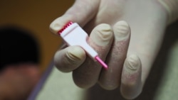 Экспресс-тест.