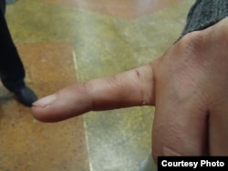 Палец Федора Орлова