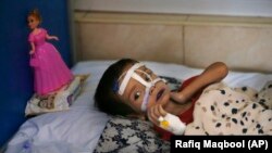 بر اساس تخمین یونیسف بیش از ۲ میلیون کودک در سال آینده با سوء تغذی در افغانستان دست و گریبان خواهند بود