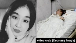 Азиза до аварии и сейчас.