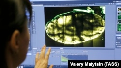 Көп фотондуу микроскоп аркылуу мээни изилдөө. Ростов-Дон шаарындагы Түштүк федералдык университет, Орусия. 2019-жылдын 8-февралы.