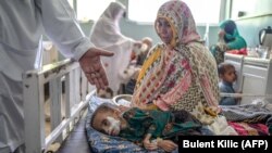 کودک مبتلا به سوء تغذیه در کندهار٬ جنوب افغانستان